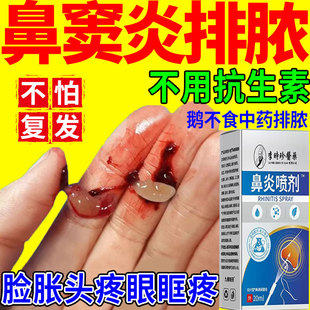 鼻炎鼻窦炎鼻塞贴专用贴药根通气鼻贴断治疗特儿童中膏喷剂效根