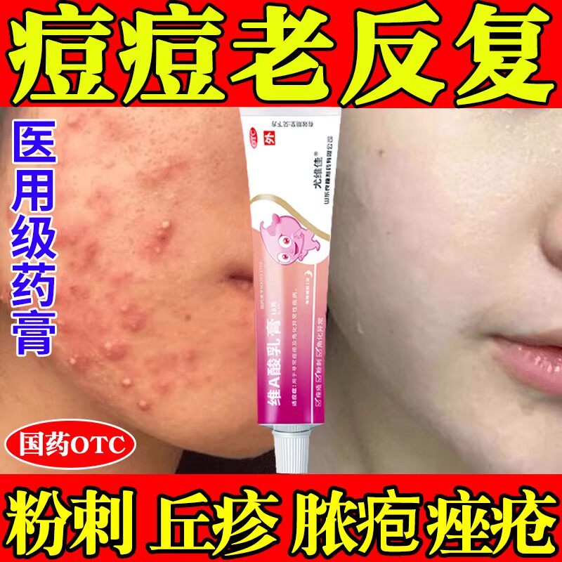 【良福】维A酸乳膏0.1%*15g*1支/盒痤疮祛痘祛斑祛痘印去黑头