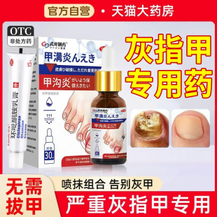治疗灰指甲专用药特环吡酮胺乳膏真菌感染药膏正品旗舰店di一名