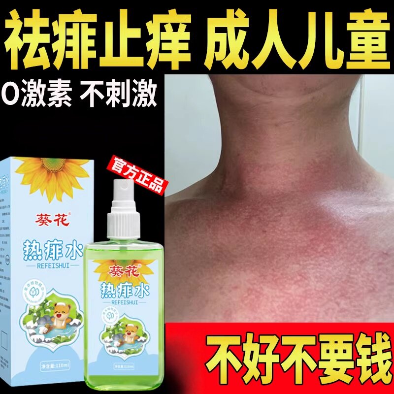 成人痱子水去痱子粉止痒水喷雾大人儿童除热痱子水祛痱专用膏防痱