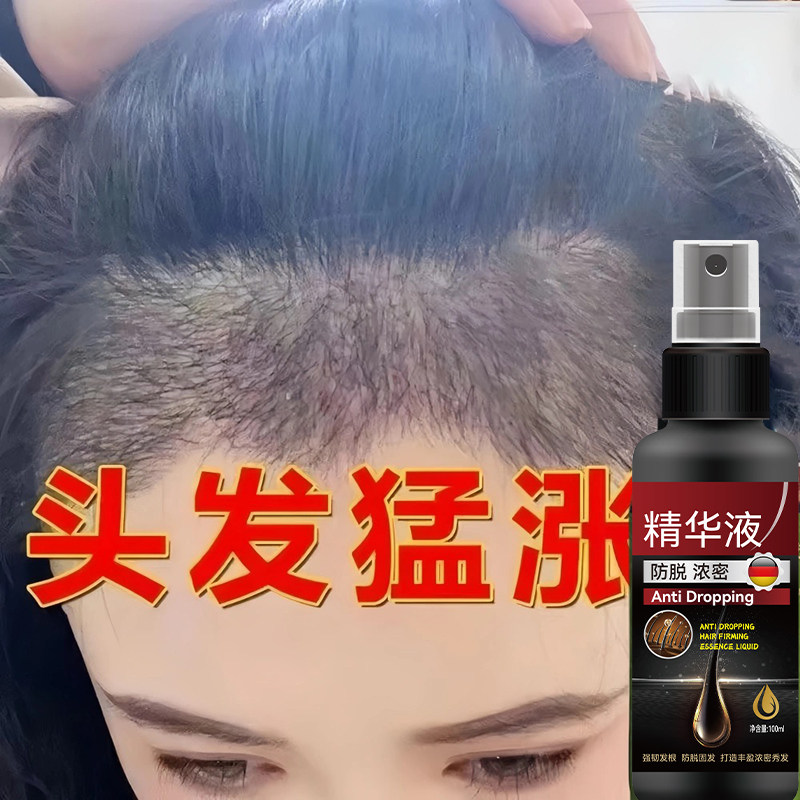【香港热卖】生发护发液防脱增发密发固发发际线快速增长精华液