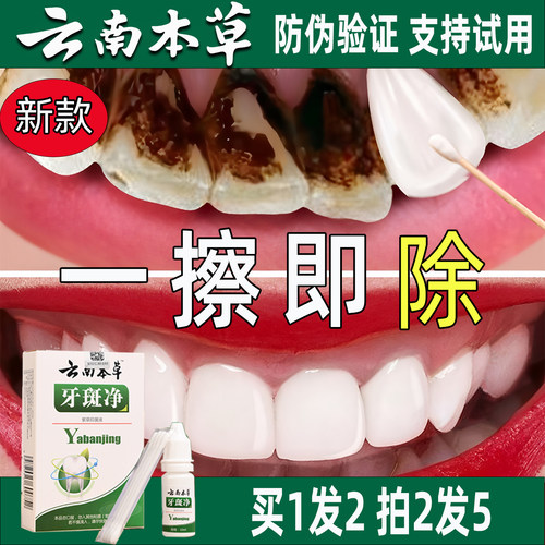 云南本草牙斑净买1送1
