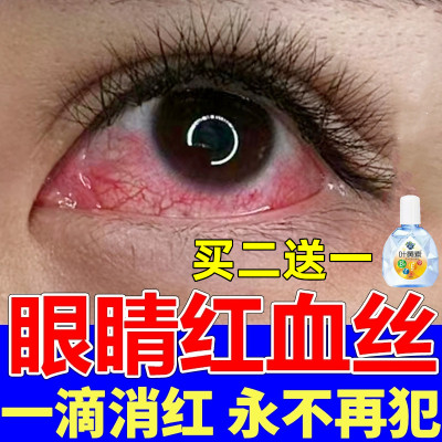 眼睛去红血丝干涩缓解疲劳滴眼液