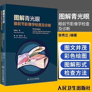 图解青光眼 眼前节影像学检查及诊断 张秀兰 青光眼诊断 房角镜 UBM OCT 裂隙灯激光虹膜葡萄膜炎人民卫生出版社 眼科学书籍