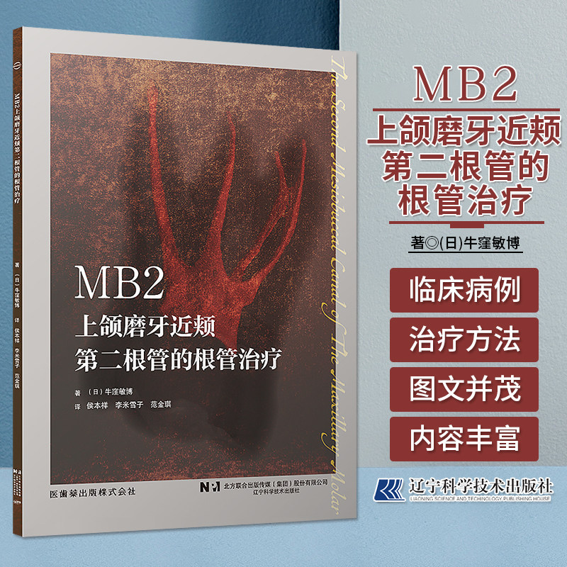 mb2上颌磨牙近颊第二根管的根管治疗 mb2解剖形态到临床处理方法技能
