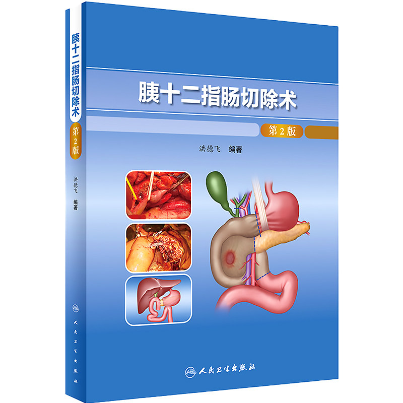 胰十二指肠切除术 第2版 洪德飞 编著 壶腹周围癌tnm分期和根治标准