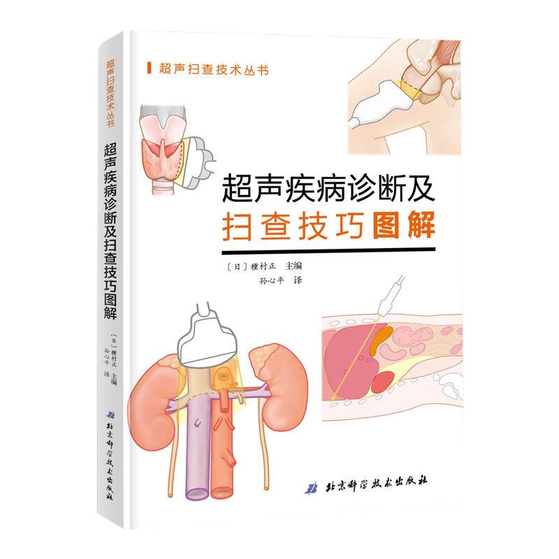超声疾病诊断及扫查技巧图解 解剖学医学影像人体断层书籍正常值测量备忘录技术入门b超血管肌骨心超笔记腹部精细讲解心脏动彩图谱