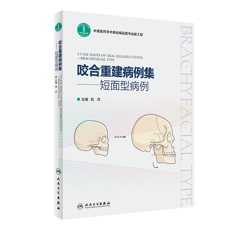 咬合重建病例集 短面型病例 口腔咬合重建病例功能分析调颌临床实用技术图解 短面型前牙磨损修复调牙合临床技术书 人民卫生出版社