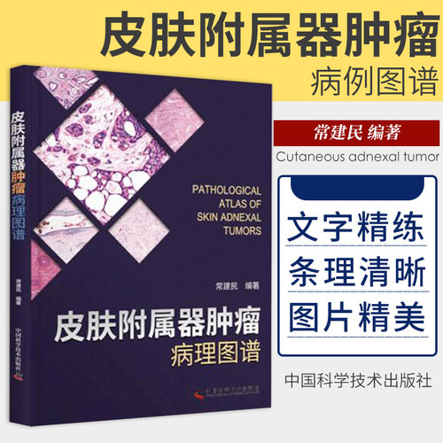 包邮正版 皮肤附属器肿瘤病理图谱 适合皮肤科临床医师以及病理科医师参考使用 种类丰富 常健民 中国科学技术出版社9787504687593