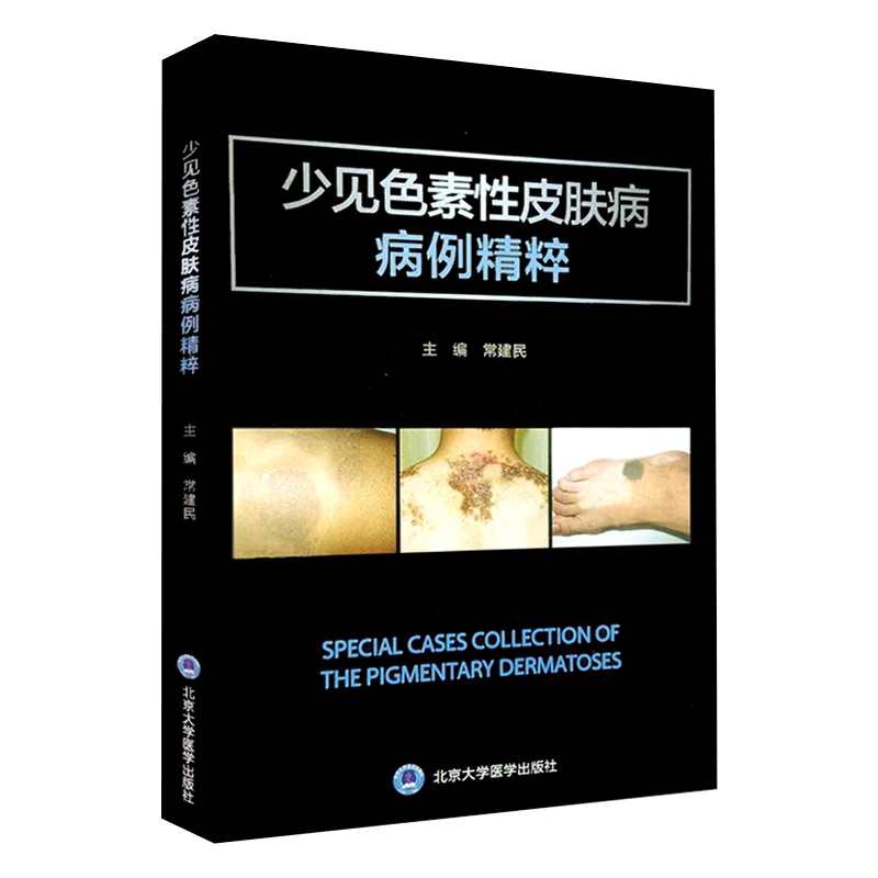 正版 少见色素性皮肤病病例精粹 常建民 主编 北京大学医学出版社 9787565922145 皮肤病学 皮肤科 图鉴 大全 皮肤病书籍