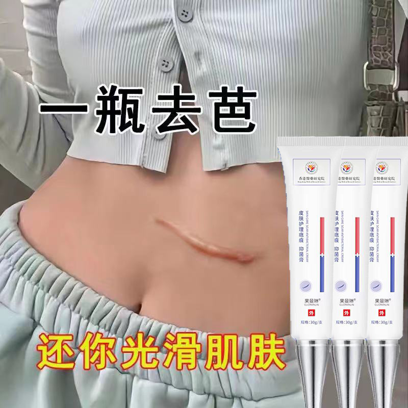 【祛除老疤】手术伤口凹凸无痕去旧疤刀疤摔伤增生膏痘印儿童