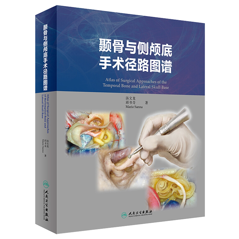 现货速发 颞骨与侧颅底手术径路图谱 汤文龙 邱书奇 Mario Sanna 著 耳鼻咽喉科学 神经外科学 人民卫生出版社9787117293228