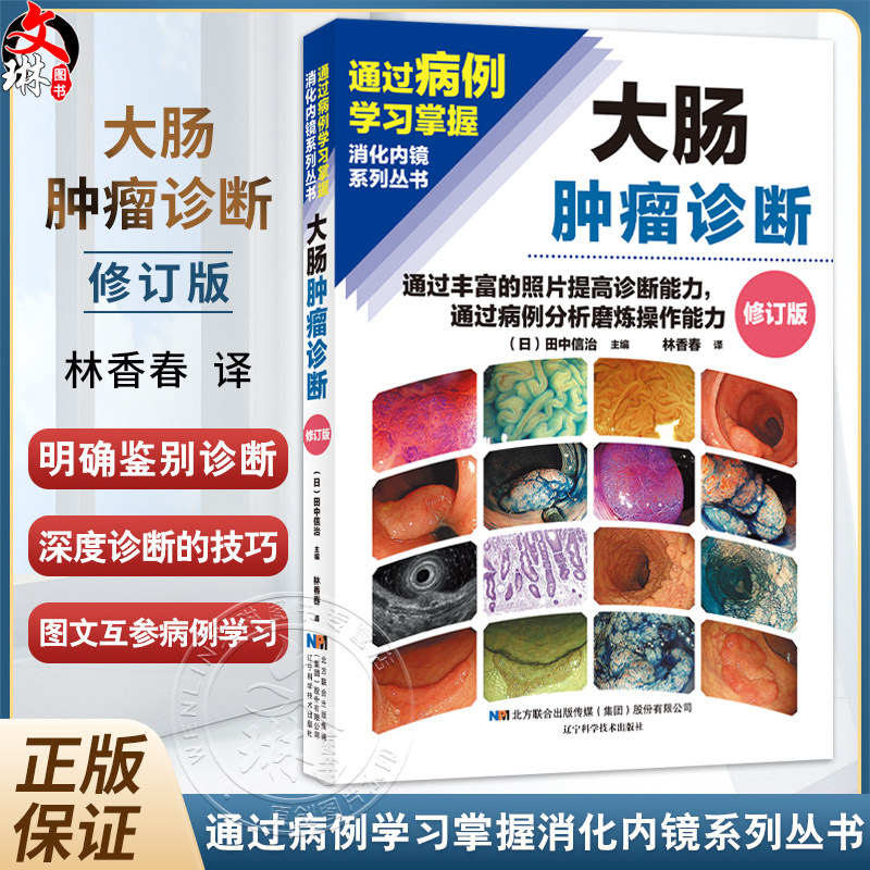大肠肿瘤诊断——通过丰富的照片提高诊断能力 通过病例分析磨炼操作能力(日)田忠信治 著 9787559135087 辽宁科学技术出版社