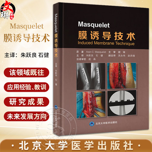 Masquelet膜诱导技术阐述了