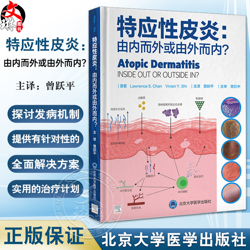 特应性皮炎由内而外或由外而内