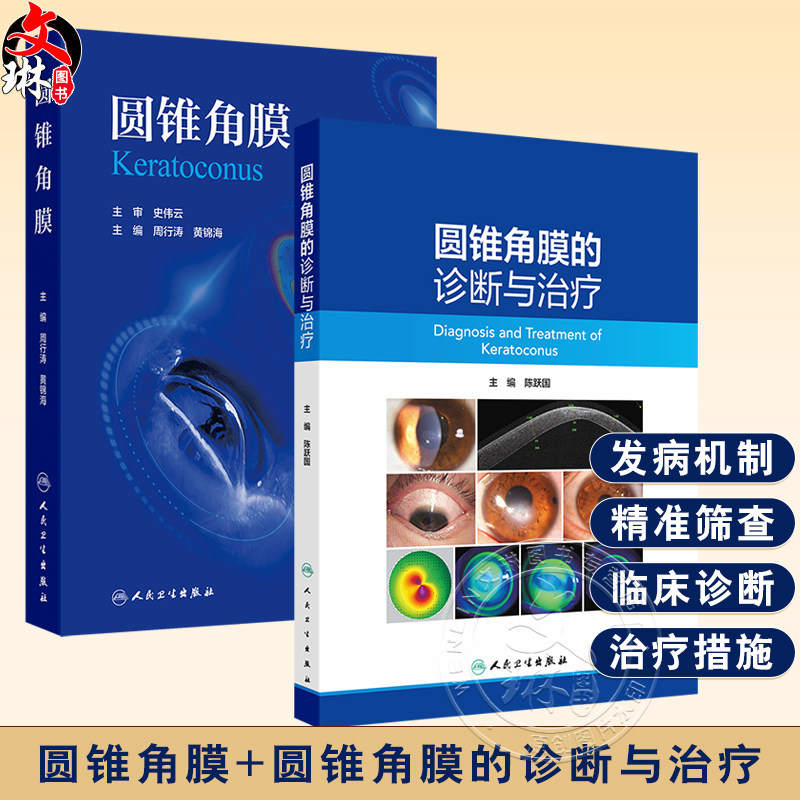 全2册 圆锥角膜+圆锥角膜的诊断与治疗 可作为临床眼科医师视光学医师医学院校学生学习和工作的参考书 眼科学 人民卫生出版社