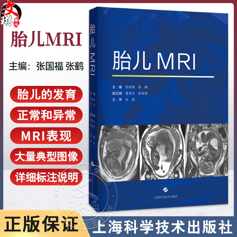 胎儿MRI 张国福 张鹤 主编 本书对从事胎儿磁共振的影像科医师和新生儿医师、产科医师都有帮助 9787547873083 上海科学技术出版社