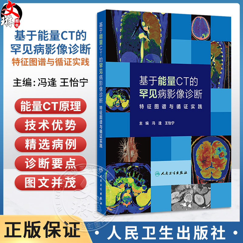 基于能量CT的罕见病影像诊断 特征图谱与循证实践 冯逢 王怡宁 本书是国内首部系统介绍罕见病CT能量成像诊断的专著人民卫生出版社