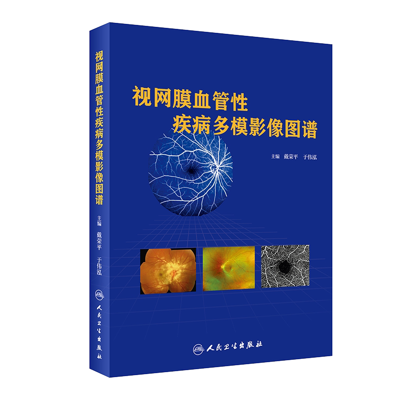现货速发视网膜血管性疾病多模