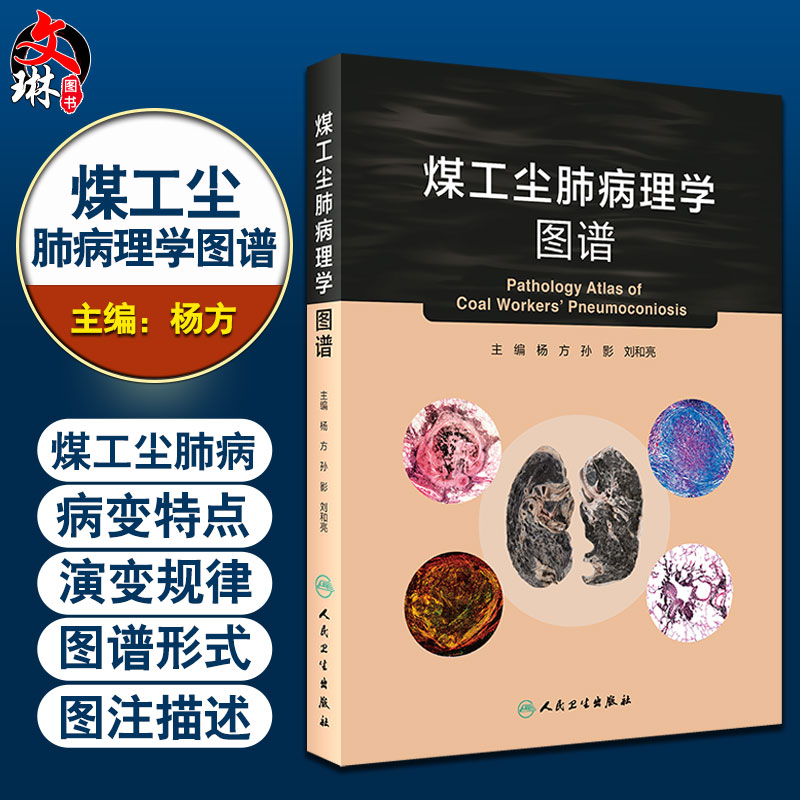 煤工尘肺病理学图谱 煤工尘肺组织形态学的特点 淋巴结的病变 杨方 孙影 刘和亮 主编 9787117310734人民卫生出版社