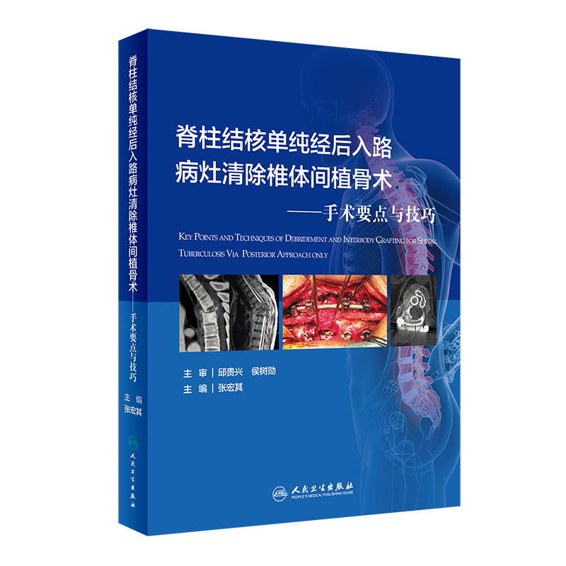 正版 脊柱结核单纯经后入路病灶清除椎体间植骨术 手术要点与技巧 张宏其 主编 骨科学外科学书籍 人民卫生出版社9787117313681