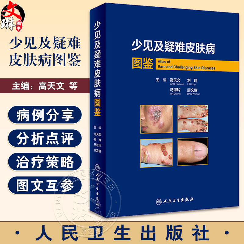 现货 少见及疑难皮肤病图鉴 高天文等编 西京皮肤医院经病理诊断的少见疾病及临床错诊获修正的不典型疾病 人民卫生出版社