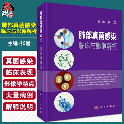 肺部真菌感染临床与影像解析肺部几大类真菌感染的临床表现和影像学特点疾病为本张嵩编 9787030657626科学出版社