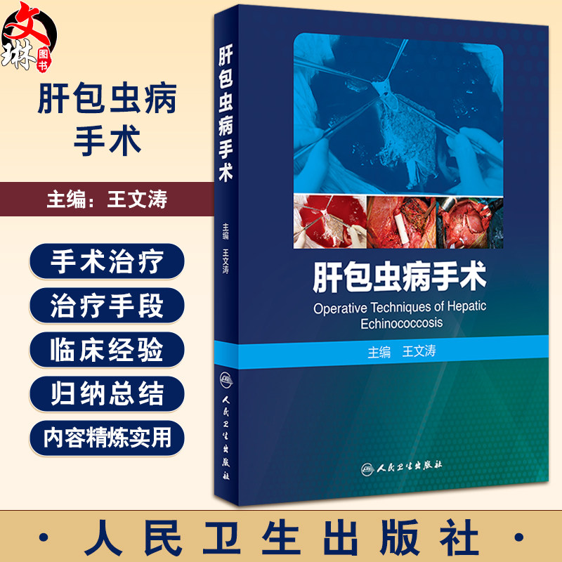 肝包虫病手术王文涛寄生虫疾病
