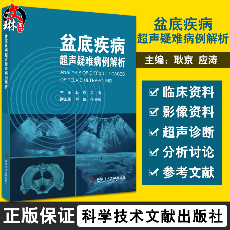 盆底疾病超声疑难病例解析 包括盆底器官脱垂、压力性尿失禁以及盆底疾病术前术后对照 耿京 主编9787518977772科学文献技术出版社怎么看?