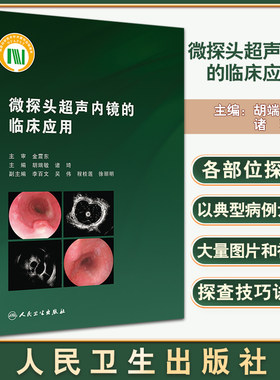 微探头超声内镜的临床应用