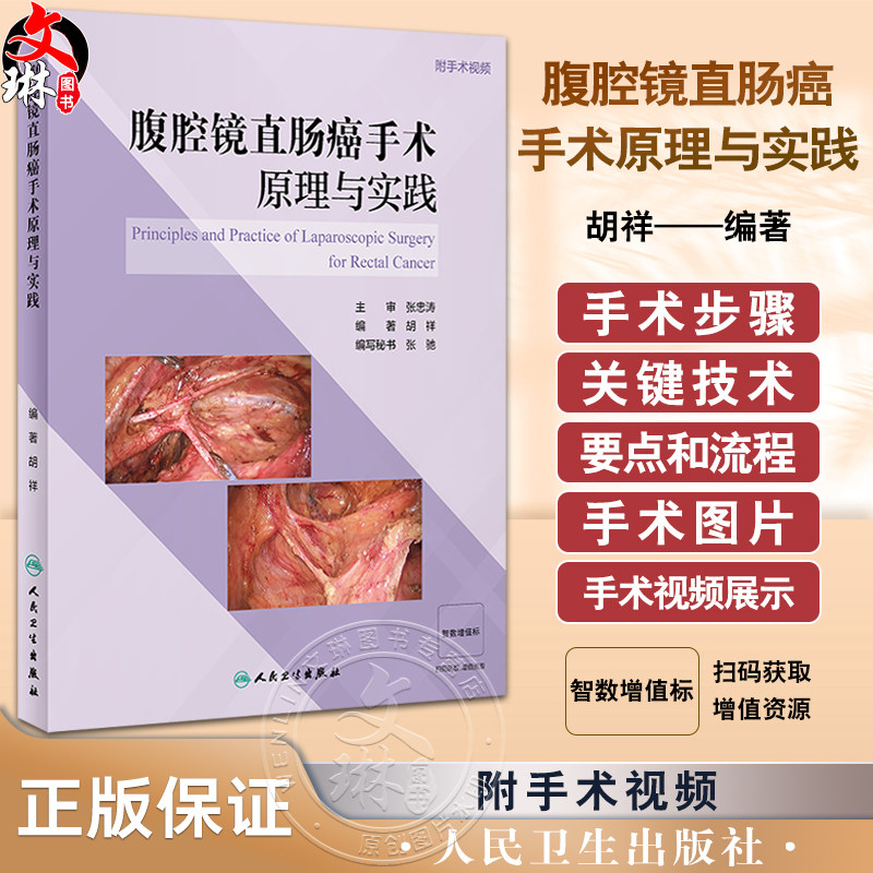 腹腔镜直肠癌手术原理与实践