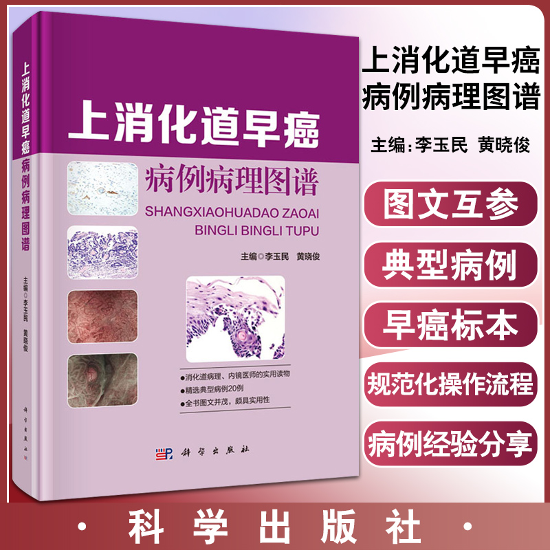 上消化道早癌病例病理图谱 超声内镜 消化道早癌相关各类标本的规范