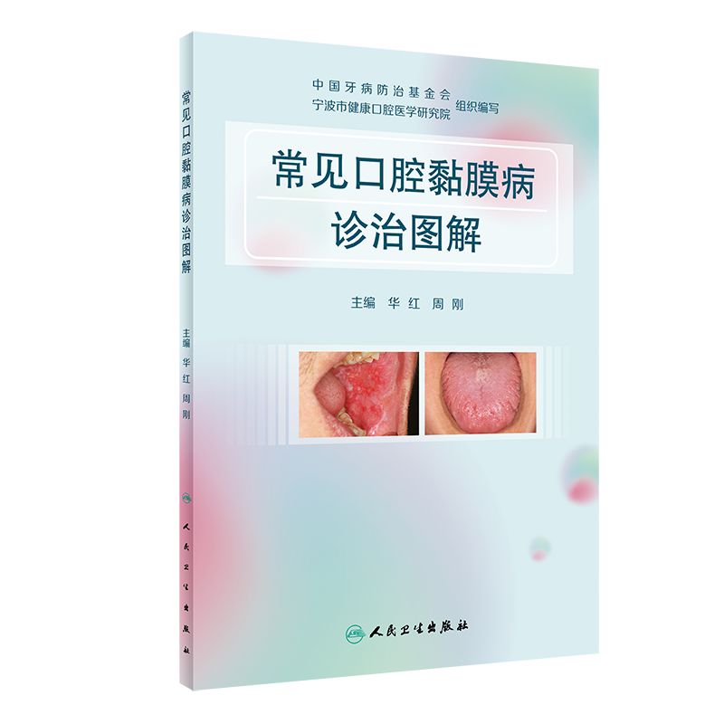 常见口腔黏膜病诊治图解 华红 周刚 口腔科学书籍 局部湿敷激光治疗 免疫调节药含漱剂涂剂用药 人民卫生出版社9787117317337