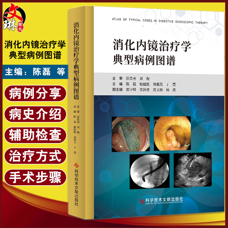 正版保障 贴心售后 收藏商品 优先发货