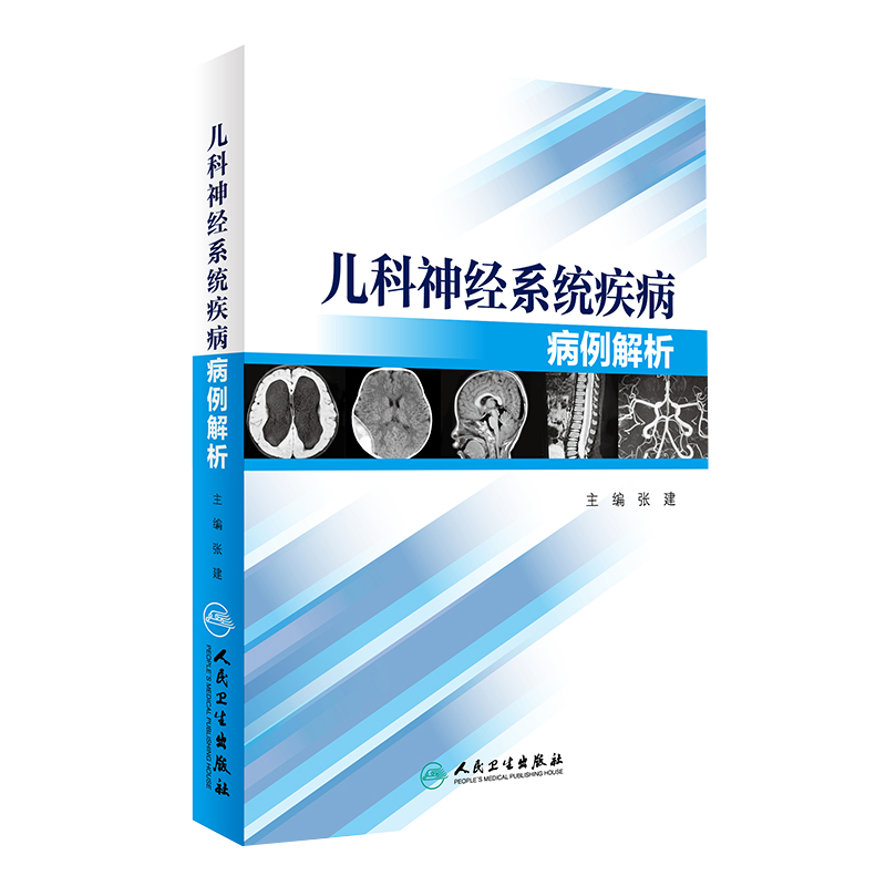 儿科神经系统疾病病例解析 张建主编 成人与小儿神经内外科 临床鉴别诊断 供相关医师和相关医学上阅读参考 9787117232111