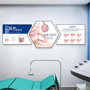 牙科门诊挂图装饰画口腔诊所墙面牙齿结构壁画医院种植牙宣传海报
