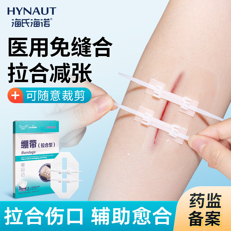 海氏海诺减张器减张贴医用剖腹产术后皮肤疤痕儿童免缝合伤口贴