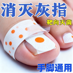 灰趾专用贴植物萃取脚趾手指甲专用 指甲贴正品 香港专研