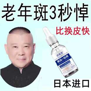 消斑正品 美白淡斑精华液黑色素老人斑晒斑焕白面部精华液原液