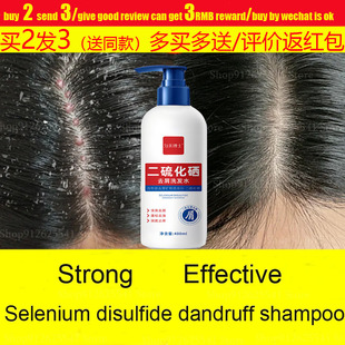 Selenium Disulfide Shampoo Anti-dandruff itch二硫化硒洗发露