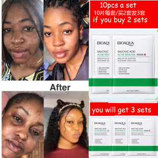 Removing Salicylic Acid Acne Moisturizing水杨酸面膜补水 mask