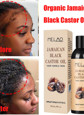 Jamaican Organic Black Castor Oil Hair Growth Scalp黑蓖麻油