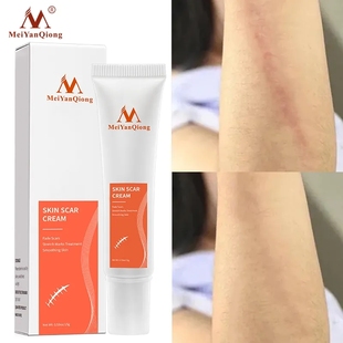 fade Scar Cream Skin Repair Face Stretch Mark smooth修复霜乳
