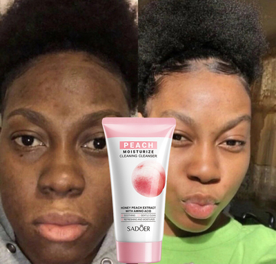 FacialCleanserShrinkPore