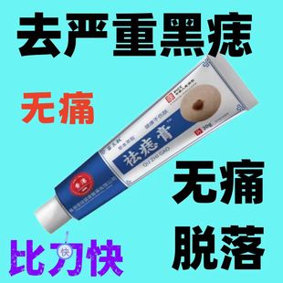 无痛消痣不留痕消痣无痕膏脸部无痛祛黑痣肉痣痦子斑点乳液