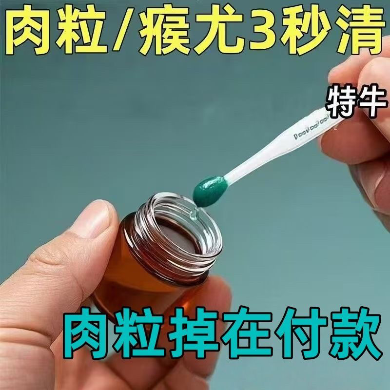 【国药专研】去尤猴肉粒脖子腋下颈部赘皮小猴子扁平尤丝状尤质膏