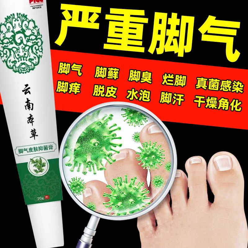 云南本草真菌王抑菌脱皮水泡烂脚足部健康