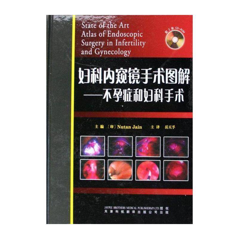 妇科内窥镜手术图解:不孕症和妇科手术  内窥镜应用不孕症妇科外科手术图 医药卫生书籍天津科技翻译出版公司