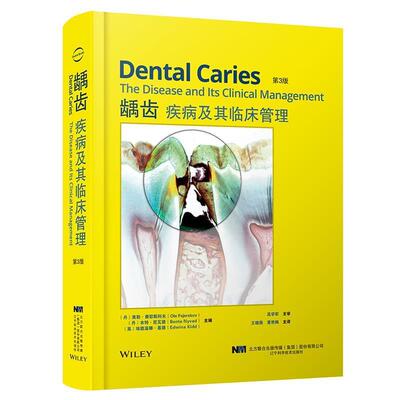 龋齿疾病及其临床管理 奥勒·费耶斯科夫 龋齿临床医学普通大众医药卫生书籍辽宁科学技术出版社