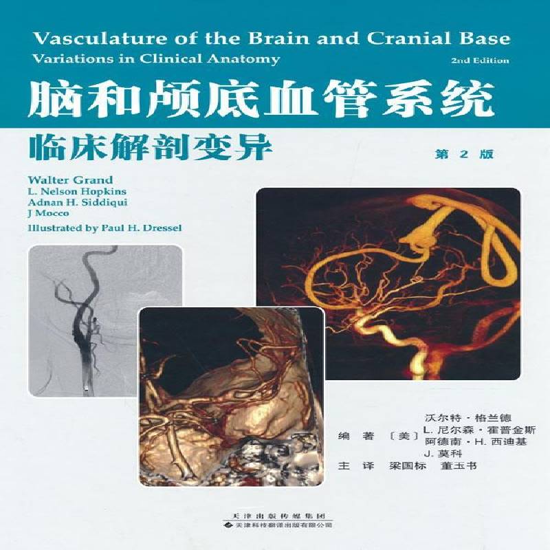 脑和颅底血管系统临床解剖变异 沃尔特·格兰德 脑血管人体解剖学图谱普通大众医药卫生书籍天津科技翻译出版